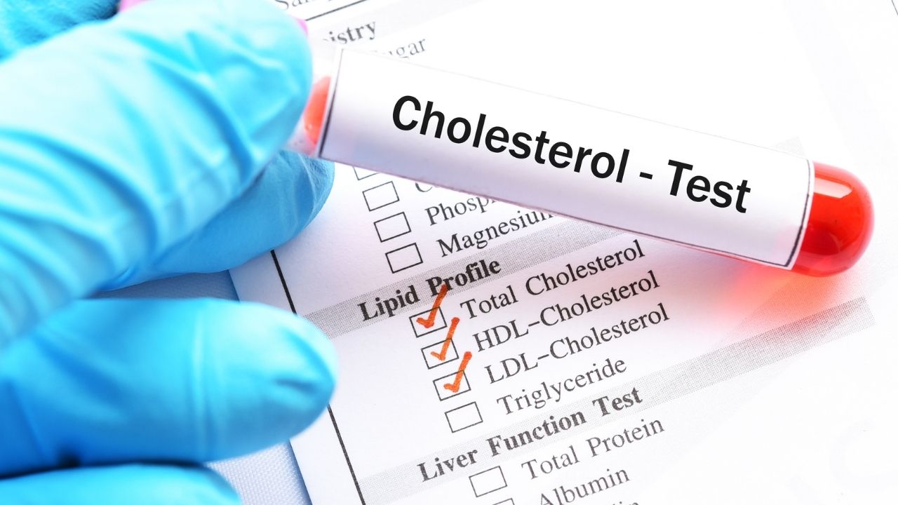 Jak wykonać pomiar cholesterolu?